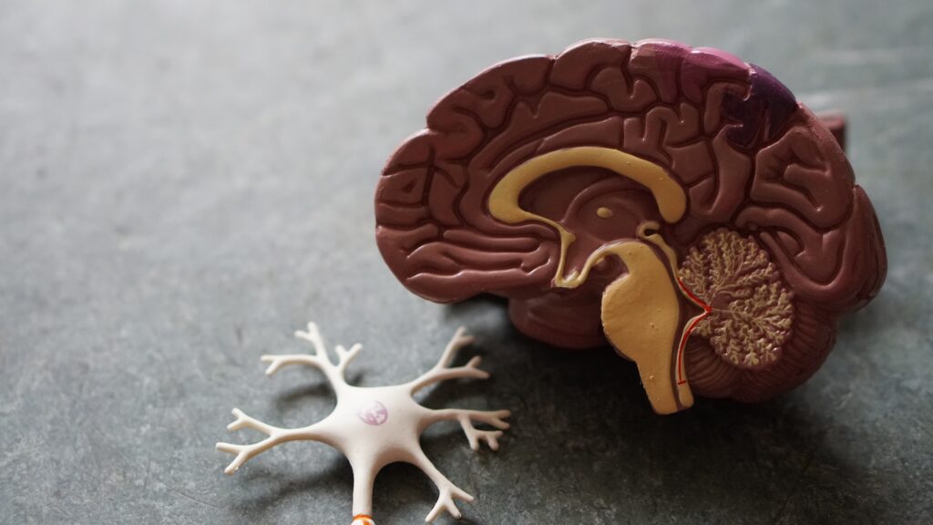 Plastic model of brain with a model cyst next to it. 